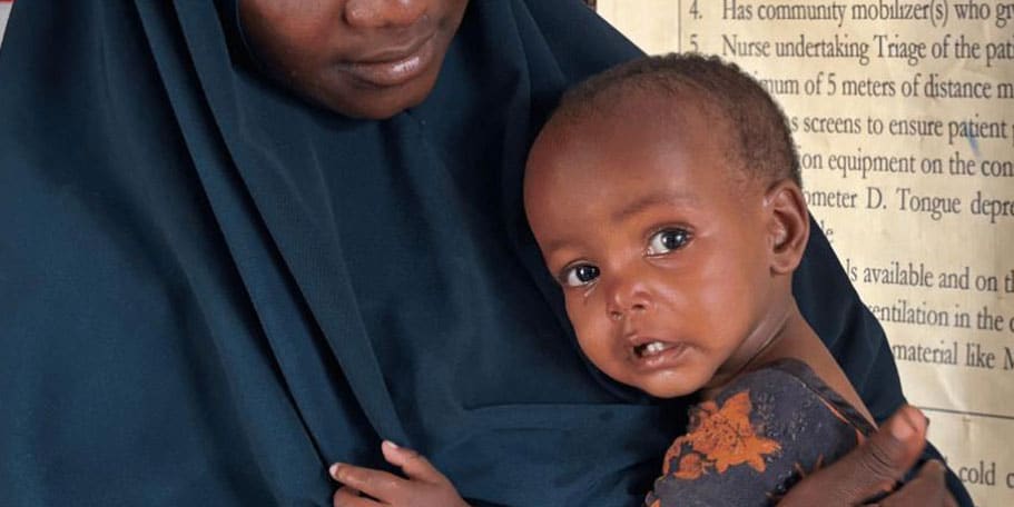 Nearly Half Children under Five in Somalia Face Acute Malnutrition: Save the Children